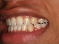 Konig Center for Cosmetic & Comprehensive Dentistry smile photos
